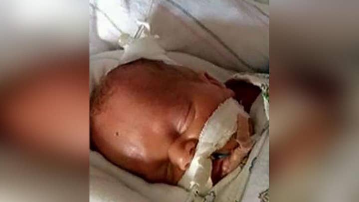 'Miracle baby' beats the odds after being given less than a one percent chance of survival when born three months early