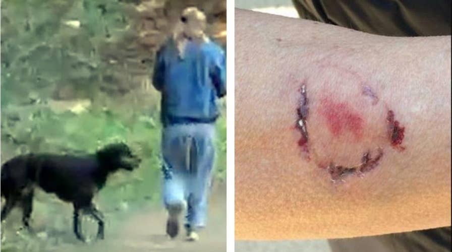 California woman arrested after biting jogger who pepper-sprayed her dog