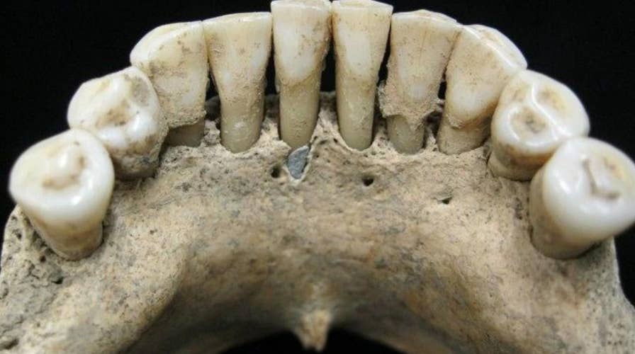 Mysterious blue pigment in medieval woman's teeth gives scientists 'bombshell' clue
