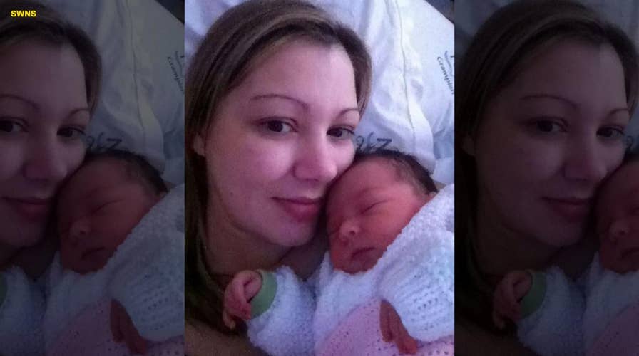 Cesarean section scar splits just days after mom gives birth to daughter