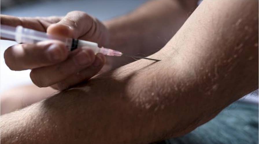 Man was injecting self with semen in attempt to relieve back pain, case report says