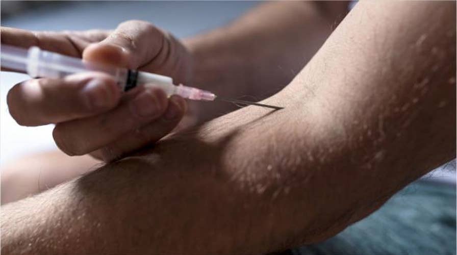 Man was injecting self with semen in attempt to relieve back pain, case report says