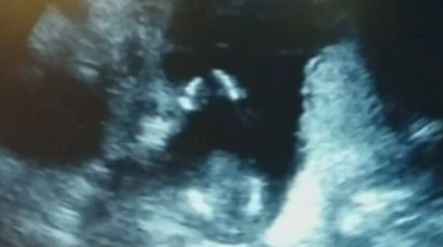 March for Life: Tens of thousands of pro-life supporters mark the anniversary of Roe v. Wade