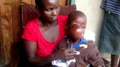 Family desperately racing to help boy, 4, with massive, painful facial tumor