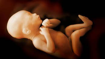 Rep. Roger Marshall: NY abortion law is a danger to mothers – I know, as a doctor who's delivered 5,000 babies