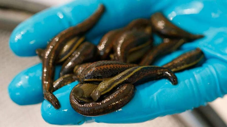 Man allegedly had thousands of leeches stuffed into luggage: report