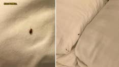 Bedbugs take over Texas hotel bedroom in skin-crawling photos: 'There was blood on the sheets'