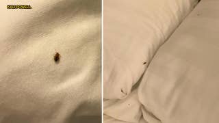 Bedbugs take over Texas hotel bedroom in skin-crawling photos - Fox News