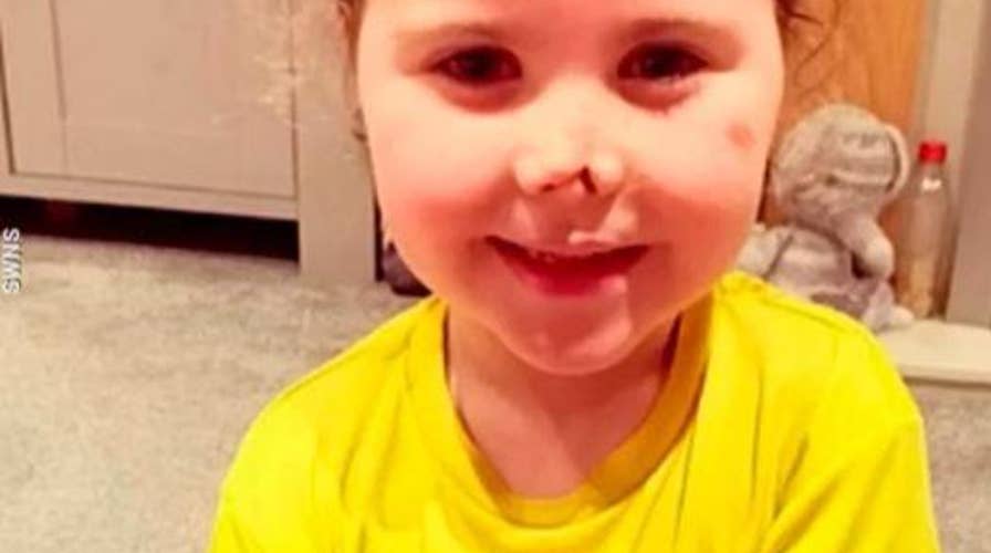 A five-year-old girl who lost all four limbs to meningitis is competing in a half marathon