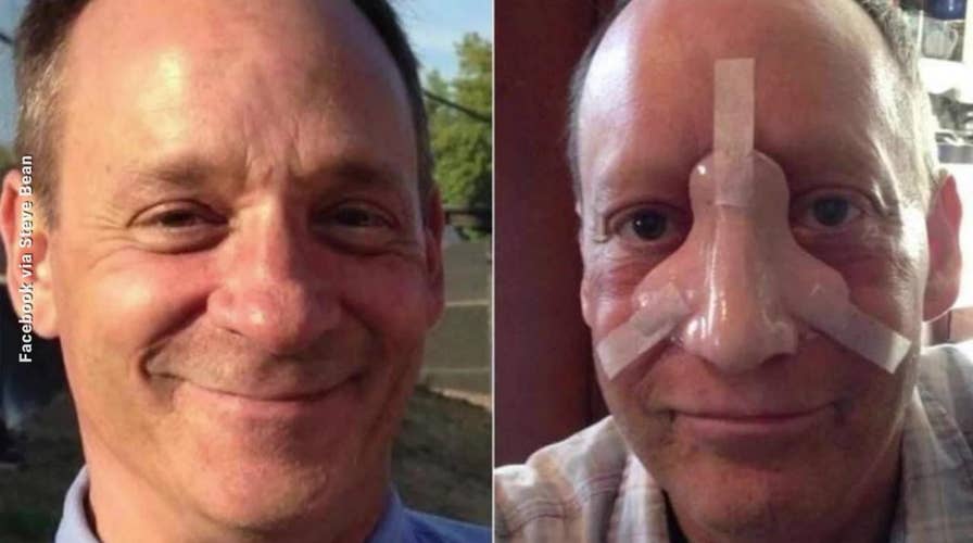 ‘Ray Donovan’ actor Steve Bean dead at 58 after battle with 'rare' nose cancer