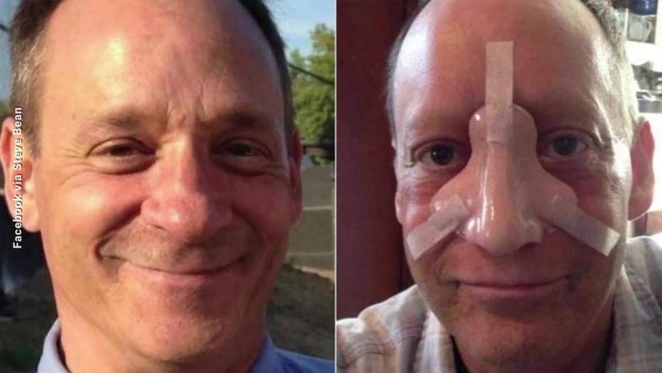 ‘Ray Donovan’ actor Steve Bean dead at 58 after battle with 'rare' nose