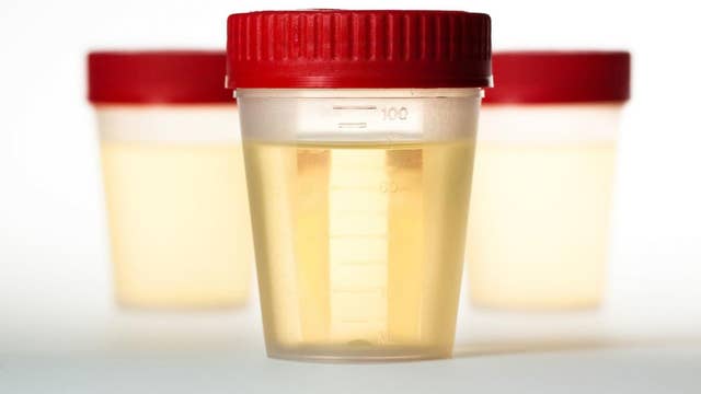 Drinking Urine Can It Help Latest News Videos Fox News