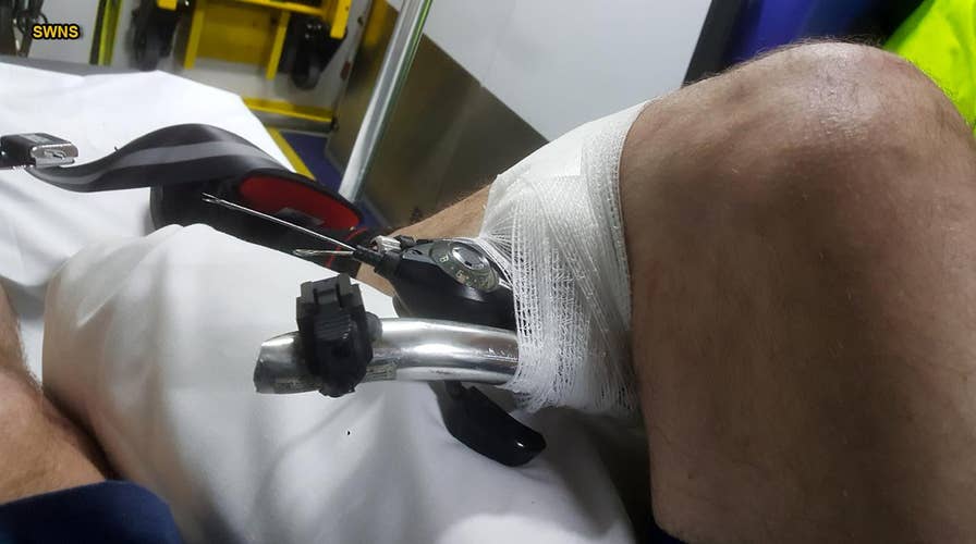 Man impaled by bike’s handlebars says accident ‘happened so fast’