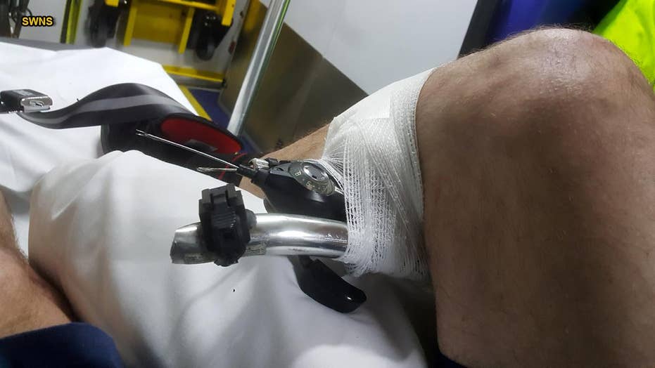 Man impaled by bike’s handlebars says accident ‘happened so fast’ Fox