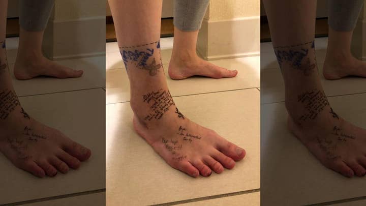 Colorado woman writes ‘breakup’ note on foot before amputation