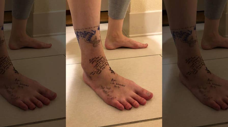 Colorado woman writes ‘breakup’ note on foot before amputation