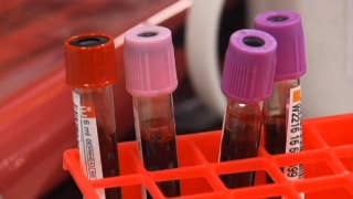 Potential breast cancer breakthrough - Fox News