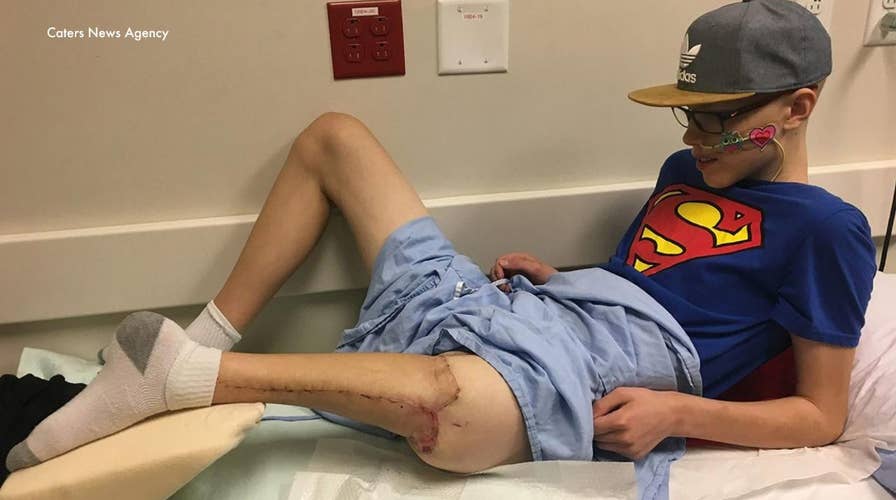 Teen's foot attached backward to form new knee after cancer surgery