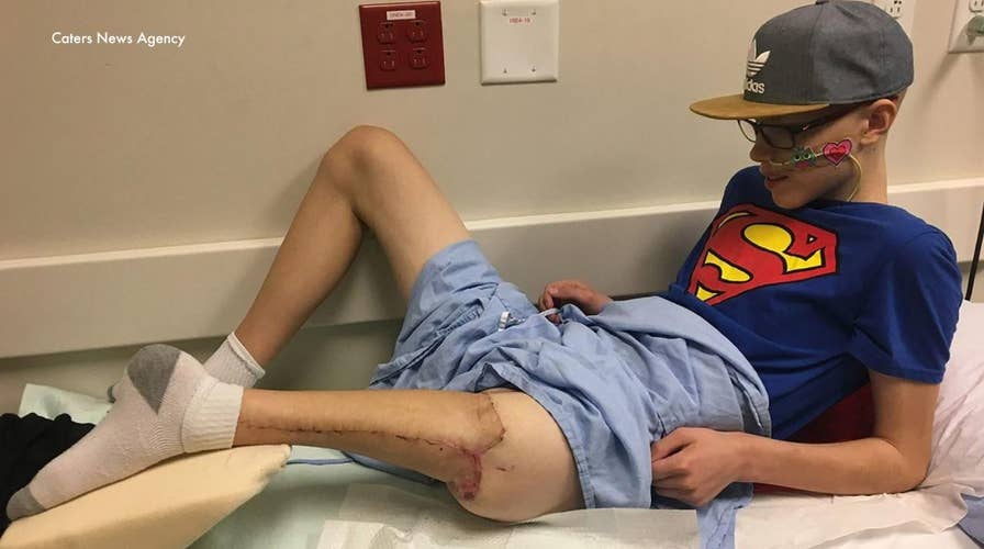 Teen's foot attached backward to form new knee after cancer surgery
