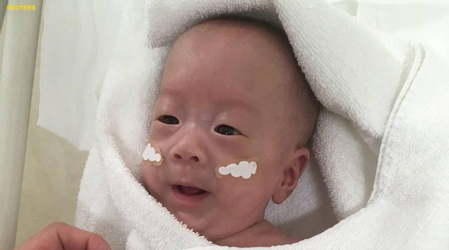 Tokyo boy believed to be world’s smallest surviving baby born at 24 weeks gestation
