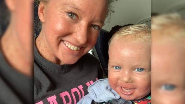 American Airlines removes mother and son because of rare skin condition