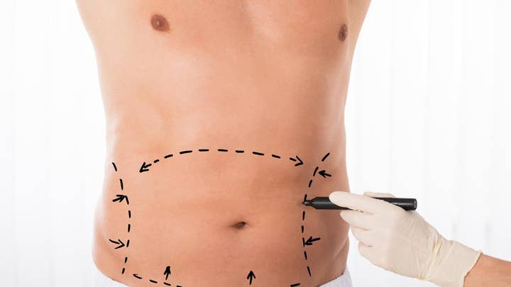 Study finds plastic surgery on the rise: Breast augmentation, liposuction among most popular procedures