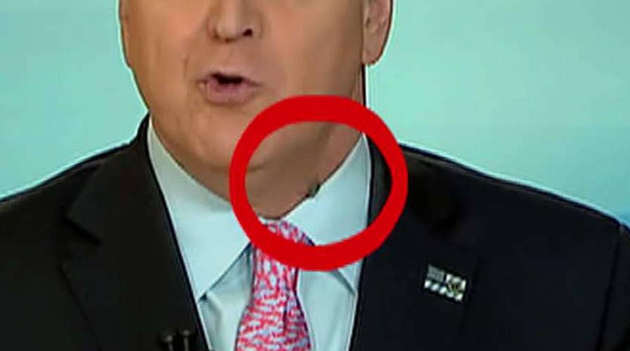 Stink bug makes Fox News debut on 'Hannity.'