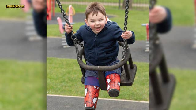 Boy severely abused as infant gets Spider-Man prosthetics to help him walk