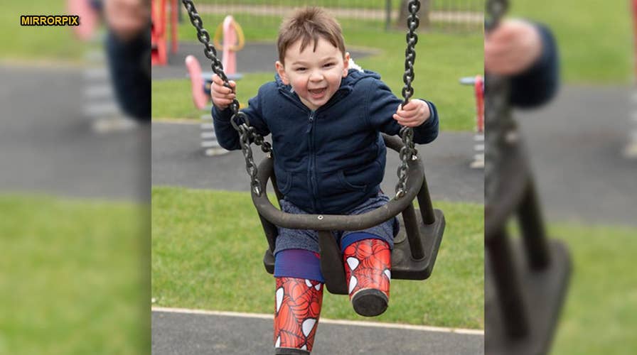 Boy severely abused as infant gets Spider-Man prosthetics to help him walk