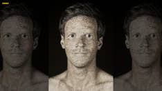 Portraits reveal 'invisible' skin imperfections caused by UV rays