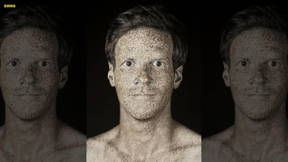 Portraits Reveal Invisible Skin Imperfections Caused By Uv Rays Fox