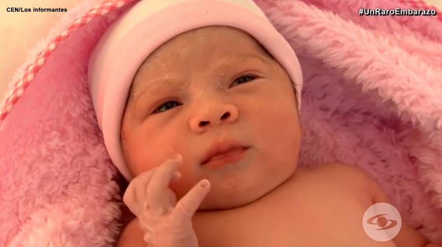 Baby born with twin growing inside her