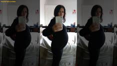 Woman's suspected 'baby bump' was actually massive ovarian tumors