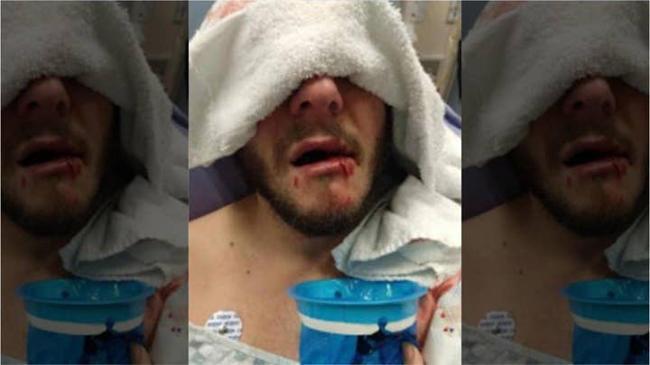 Denny's customer attacked while defending Denny's employees: 'I don't like seeing people treated that way'