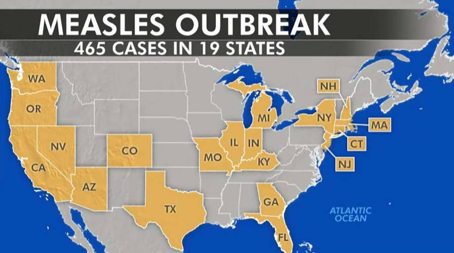 Medical experts blaming anti-vaxxers for nationwide measles outbreak