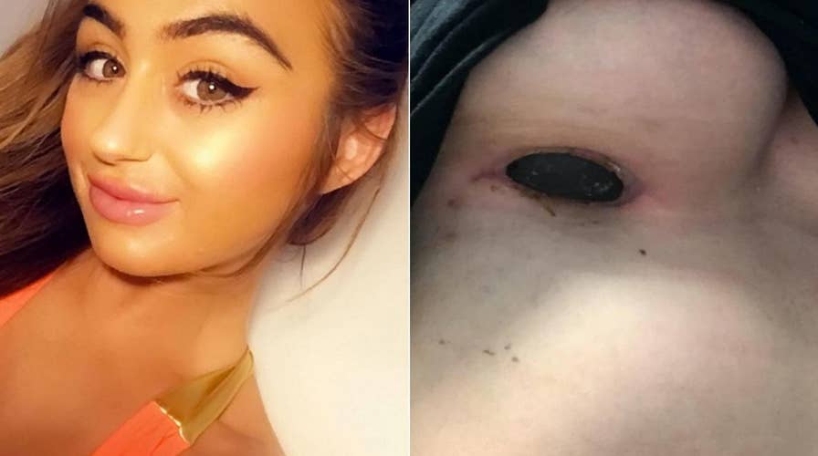 Woman claims implant scar smelled 'like rotten meat'