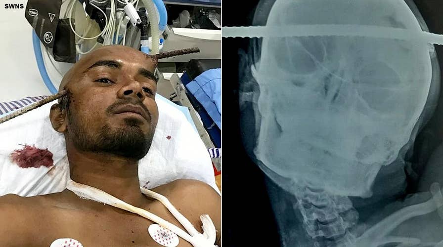 Construction worker survives after iron rod pierces through his head