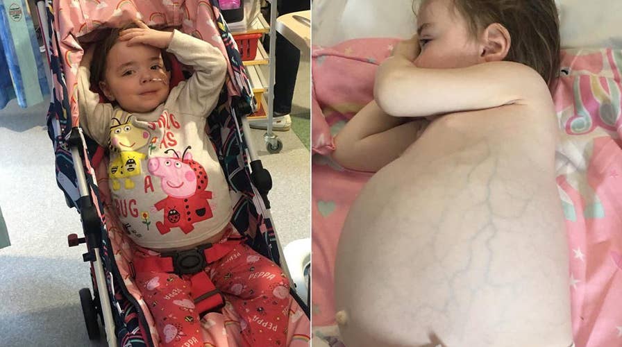 Toddler diagnosed with rare, aggressive tumor after mom noticed massive swelling in stomach