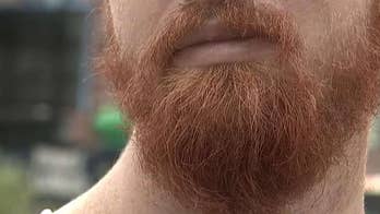 Beards evolved so men could take punches to the head, study finds