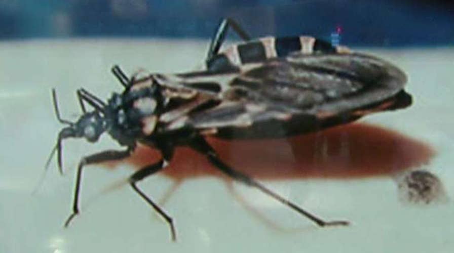 Deadly 'kissing bug' moves north through US