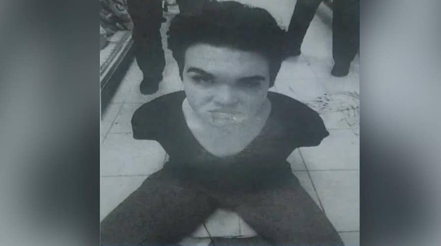 Warning, graphic content: Suspect accused of biting off part of store clerk's face in Massachusetts