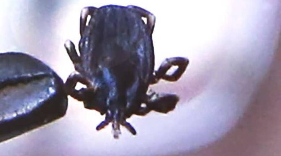 New England Journal of Medicine: 9-year-old Connecticut boy gets a tick removed from his right eardrum