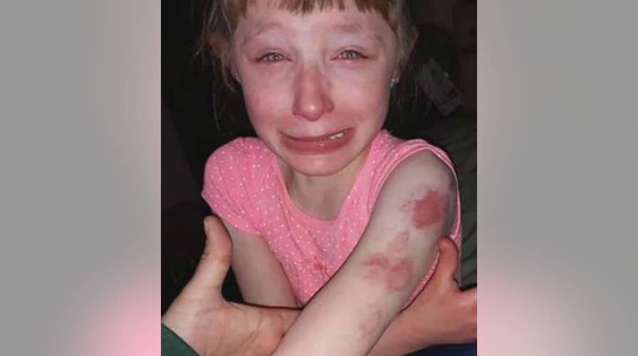 Restrained special-needs student, 10, 'brutally' bitten on school bus while driver did nothing, parents allege