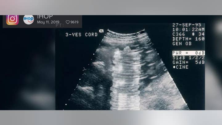 IHOP under fire for tweeting a sonogram image of pancakes inside a womb in honor of Mother’s Day