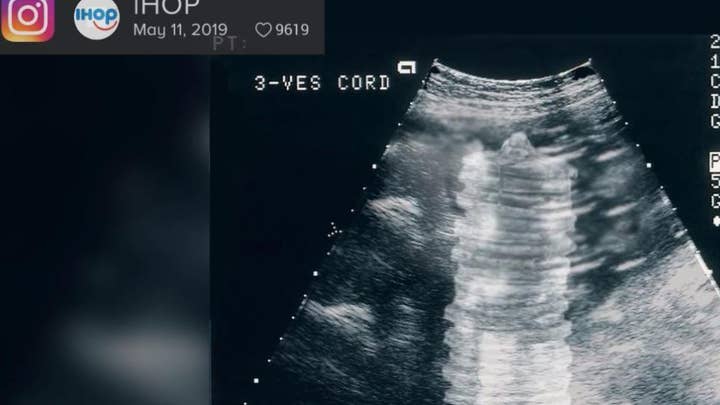 IHOP under fire for tweeting a sonogram image of pancakes inside a womb in honor of Mother’s Day