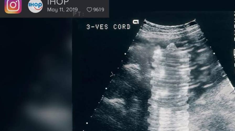 IHOP under fire for tweeting a sonogram image of pancakes inside a womb in honor of Mother’s Day