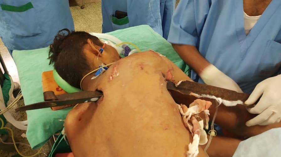 A driver in India miraculously survives being impaled by a 2.5-foot-long iron spike