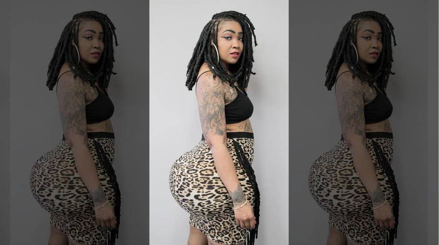 Popular Instagram model regrets illegal butt injections