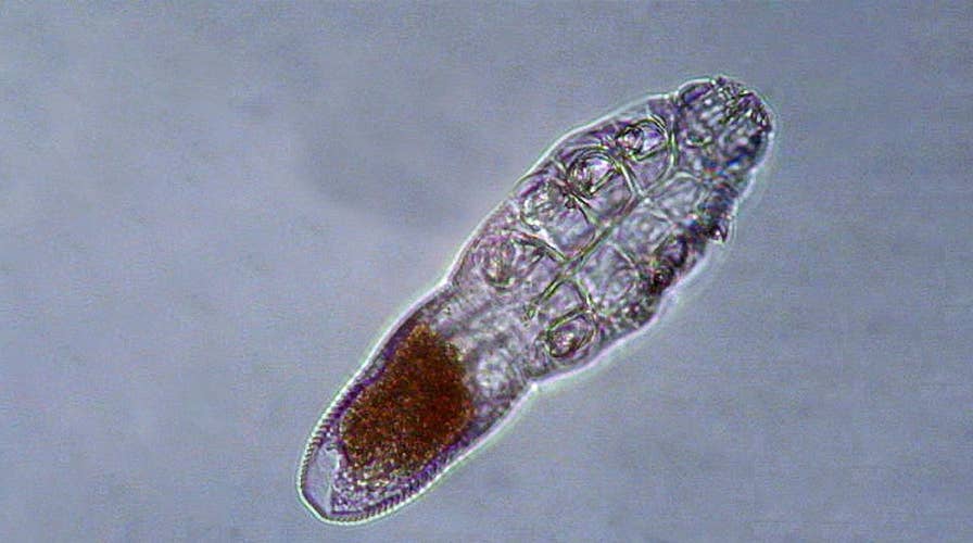 Face mites feast on skin oils while you sleep