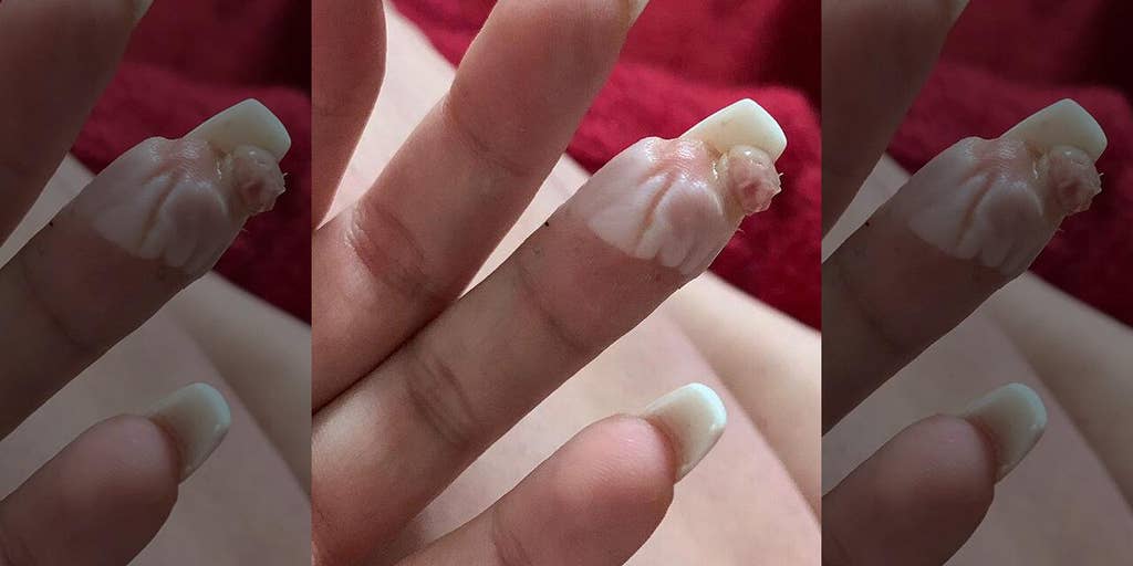 Melodramatisch Kaal humor Woman claims botched acrylic nail job nearly cost her a finger: 'I'll never  get my nails done again' | Fox News